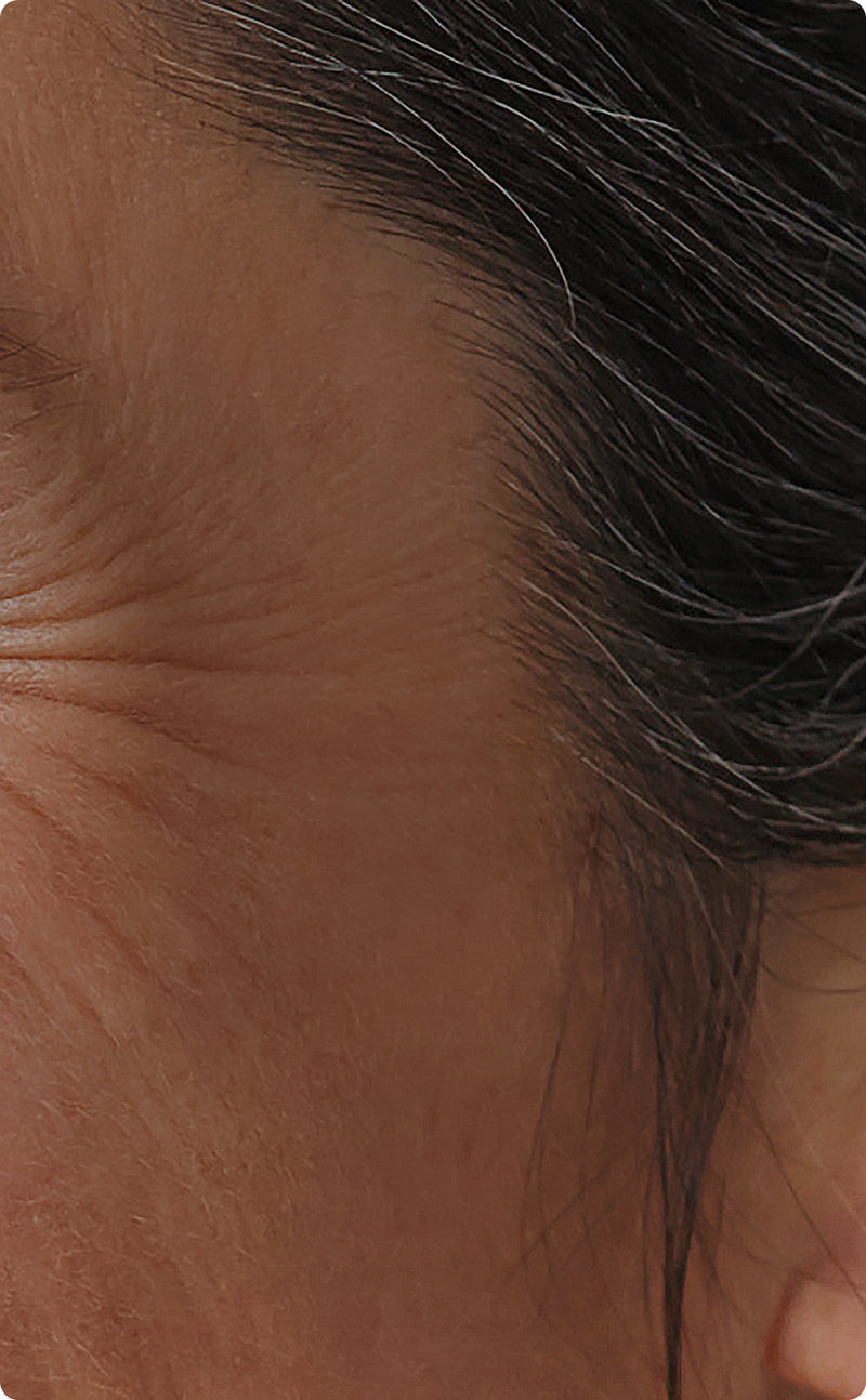 Healthy aging